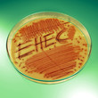 EHEC in Petrischale