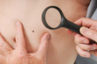 dematologie