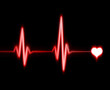 ekg