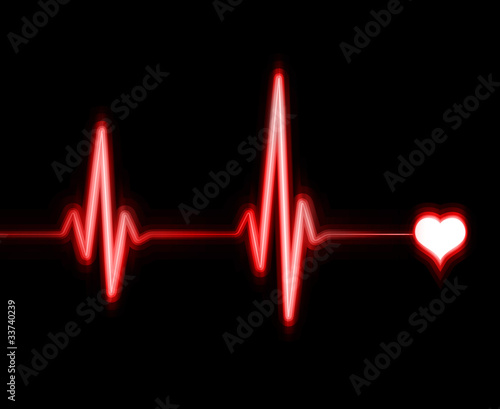Illustration: ekg ekg