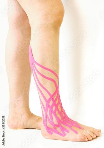 Photo: ancle contusion and therapeutic tapes ancle contusion and therapeutic tapes