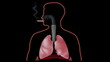 Smoker's lungs with tar and tumor
