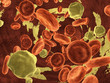 Cholesterol in a vein