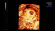 4D Ultrasound Pregnancy