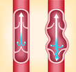 veins of the person under varices