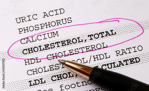 Photo: Focus on the cholesterol in a blood test report Focus on the cholesterol in a blood test report