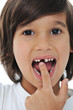 Lost milk tooth, cute boy with long hair