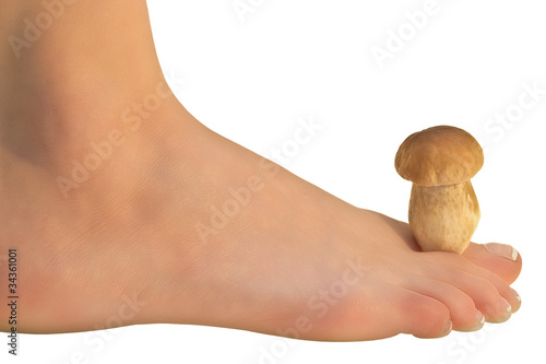 Photo: Fußpilz Fußpilz