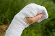 Photo: Bandaged hands Bandaged hands