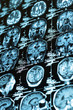 Ct scan of the human brain tile