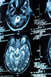 Ct scan of the human brain tile