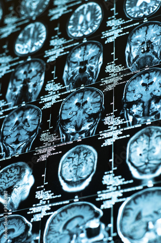 Photo: Ct scan of the human brain tile Ct scan of the human brain tile