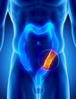 Male COLON problem - digestive system