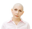 Portrait of bold woman - real cancer patient