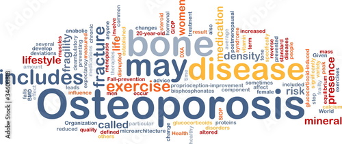 Illustration: Osteoperosis bone background concept Osteoperosis bone background concept