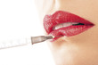 lippen botox