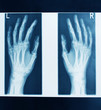 x-ray picture