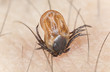 Tick feeding on human, extreme close up