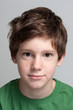 Portrait of a cute teenage boy with face covered with pimples. Portrait of a cute teenage boy with face covered with pimples.