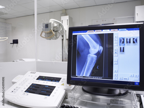 Photo: x-ray picture of a knee x-ray picture of a knee