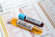 medical report with tubes of blood and urine medical report with tubes of blood and urine