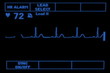 Heart Monitor EKG Screen Heart Monitor EKG Screen