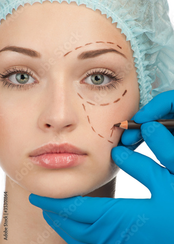 Photo: Face before plastic surgery operation Face before plastic surgery operation