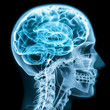 X-ray close up with brain and skull concept