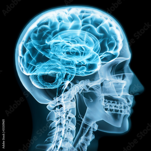 Illustration: X-ray close up with brain and skull concept X-ray close up with brain and skull concept