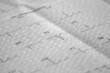 Electrocardiogram