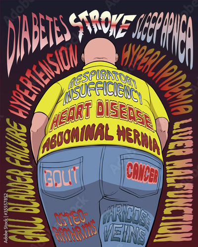 Illustration: Health Risks of Obesity Health Risks of Obesity
