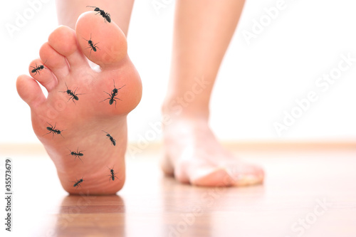 Photo: Foot stepping ant chicle diabetes leg Foot stepping ant chicle diabetes leg