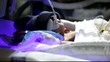 premature baby in a incubator