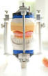 Denture
