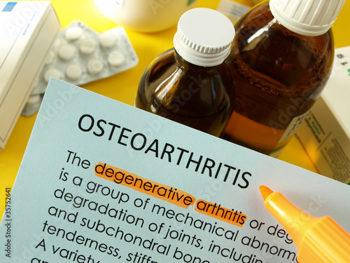 Photo: Osteoarthritis Osteoarthritis