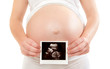 Schwangere Frau hält Ultraschallbild vor ihren Bauch