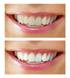 Bleaching effect