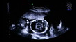 4D Ultrasound Pregnancy