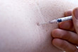 piqûre injection