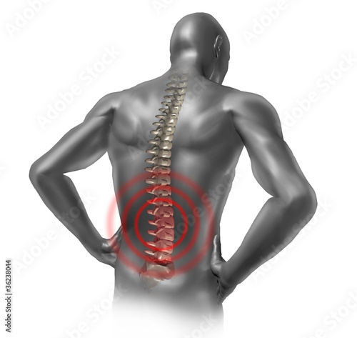 Illustration: Human back pain Human back pain