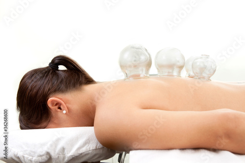 Photo: Cupping Treatment Detail Cupping Treatment Detail