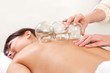 Photo: Fire Cupping Fire Cupping