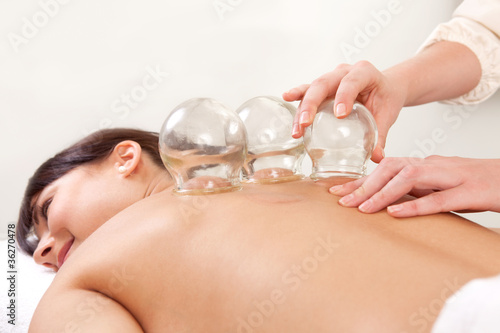 Photo: Fire Cupping Fire Cupping