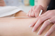 Woman having leg waxed Woman having leg waxed