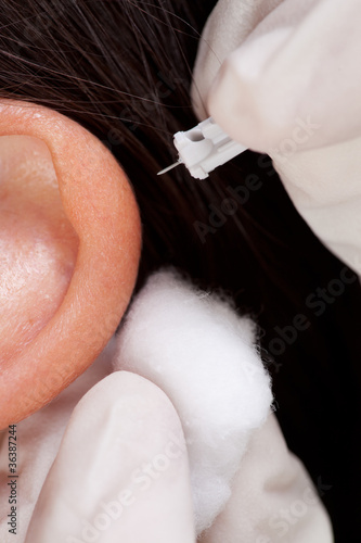Photo: Auricular Acupuncture Macro Auricular Acupuncture Macro