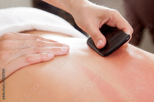 Photo: Gua-Sha Acupuncture Treatment on Back Gua-Sha Acupuncture Treatment on Back