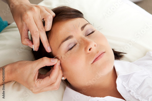 Photo: Acupuncture Therapist Placing Needle in Face Acupuncture Therapist Placing Needle in Face