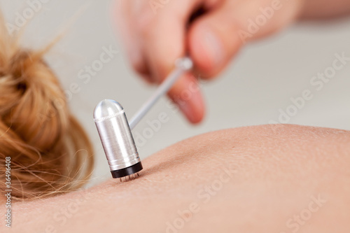 Photo: Plum Blossom Acupuncture Treatment Plum Blossom Acupuncture Treatment