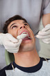 Dental Molds