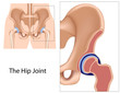 Hip joint structure, eps8